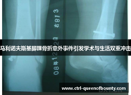 马利诺夫斯基脚踝骨折意外事件引发学术与生活双重冲击